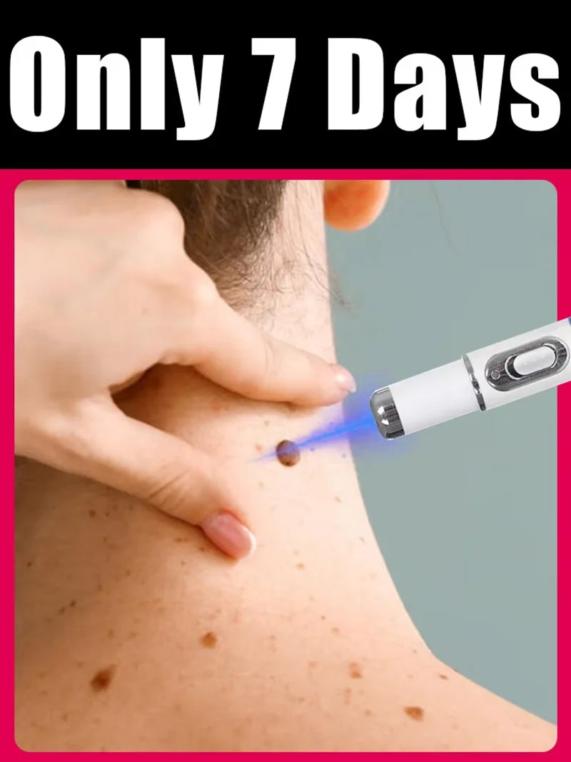 2026NEW blue light pen solve warts, hot sale wart care tools Main image