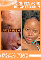 Natural Turmeric Whitening Body Wash, Deeply Clean Skin, Remove Dark Spot, Pimple, Acne, Smooth Skin, For Face & Body Soap Bar