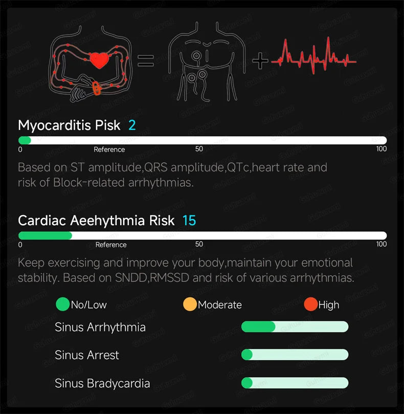 ECG High-end Health Smart Watch Men Blood pressure lipids bloodoxygen Body analysis Uric acid Health Tracker Smartwatch Men lady