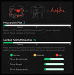 ECG High-end Health Smart Watch Men Blood pressure lipids bloodoxygen Body analysis Uric acid Health Tracker Smartwatch Men lady